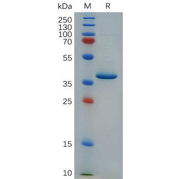Human PRAME Protein, hFc Tag