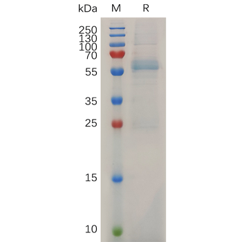 Human MMP11 Protein, hFc Tag