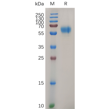 Human KLK3 Protein, hFc Tag