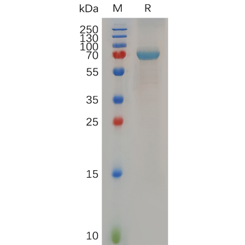 Human IGFBP2 Protein, hFc Tag