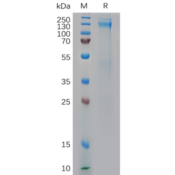 Human HAGE Protein, hFc Tag