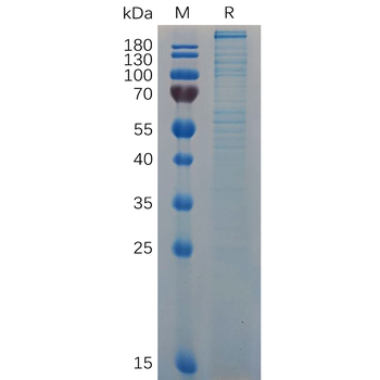 Human EGFR5 Protein, hFc Tag
