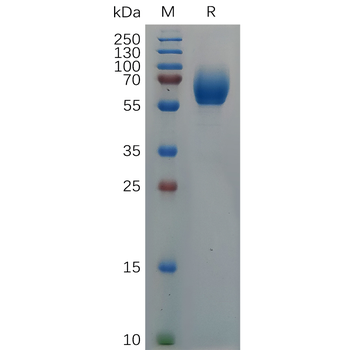 Human CCR5 Protein, hFc Tag