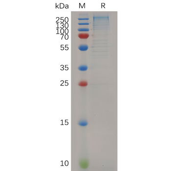 Human CCR1 Protein, hFc Tag