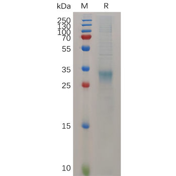 Human CALR Protein, His Tag