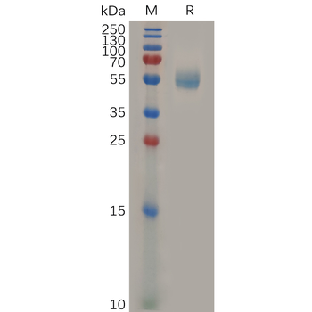 Human BRD4 Protein, hFc Tag