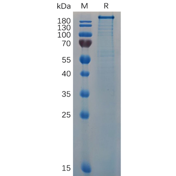 Human ACPP Protein, hFc Tag