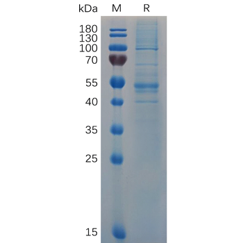 Human MAGEA4 Protein, His Tag