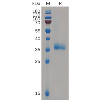 Human IL9R Protein, hFc Tag
