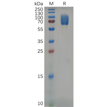 Human EPS8 Protein, hFc Tag