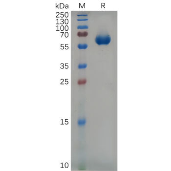 Human CRLF2 Protein, hFc Tag