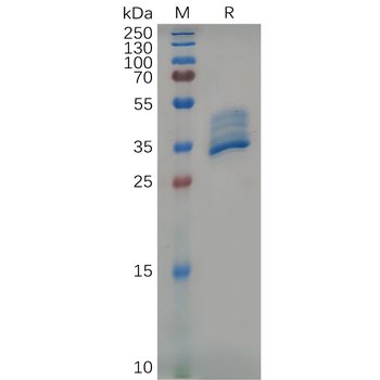 Human COLEC10 Protein, hFc Tag