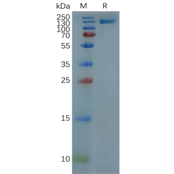 Human TNFRSF11A Protein, hFc Tag