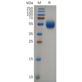 Human IL17RB Protein, hFc Tag