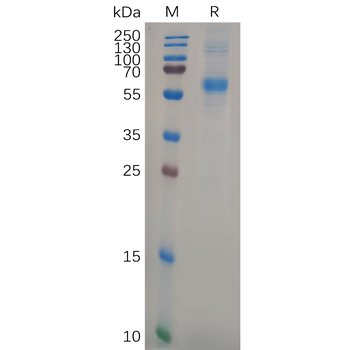 Human ANGPT2 Protein, hFc Tag