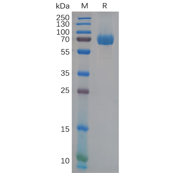 Human CXCR1 Protein, hFc Tag