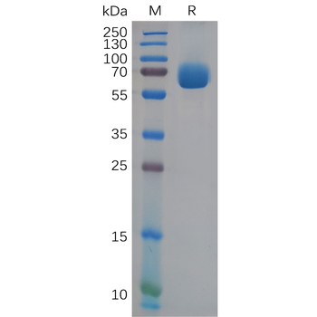 Human CD39 Protein, hFc Tag