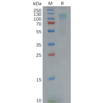 Human ITGAM Protein, hFc Tag