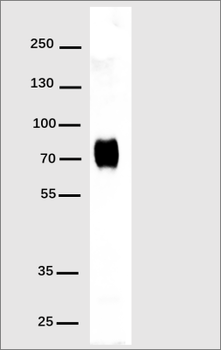 His Tag Antibody