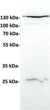 Anti-CD24 antibody(DMC213); IgG1 Chimeric mAb