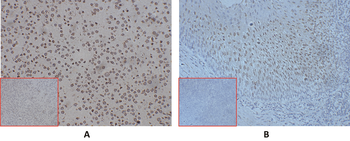 Anti-CD24 antibody(DMC213); IgG1 Chimeric mAb