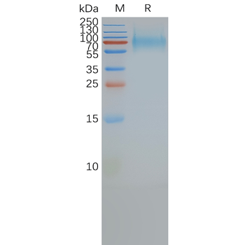 Human SSTR2 full length protein-synthetic nanodisc
