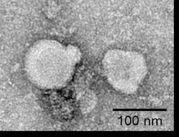 Human GPRC5D full length protein-exo