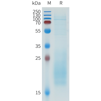 Mouse BMP6 Protein, His Tag