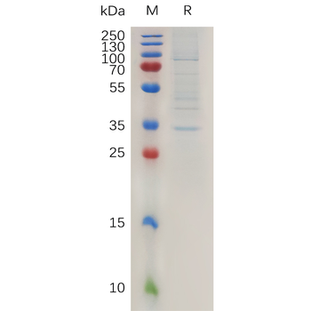 Human PCDH18 Protein, His Tag