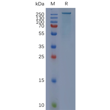 PE-conjugated Human GPRC5D Protein, mFc Tag