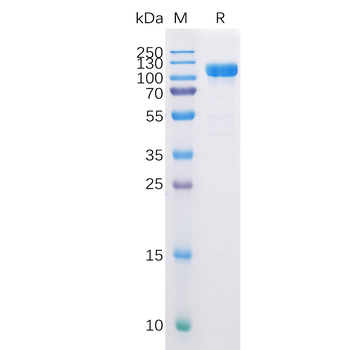 Human EDA Protein, hFc Tag