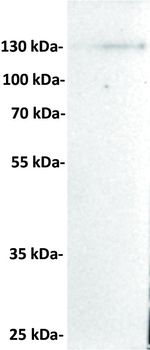 Anti-CD21 antibody(DMC280); IgG1 Chimeric mAb