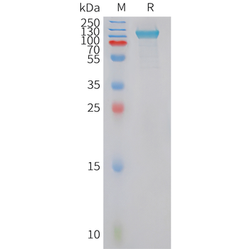 Human CXCL6 (C-6His) Protein