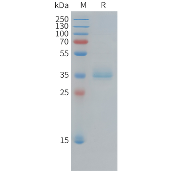 Human FGF-19 (N-6His) Protein