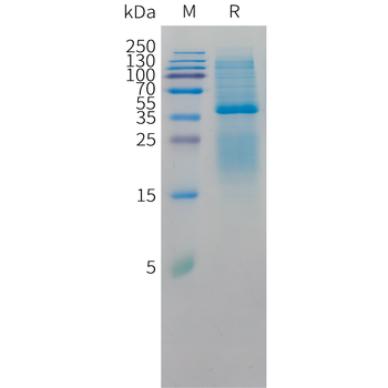 Human CCL24 (C-6His) Protein