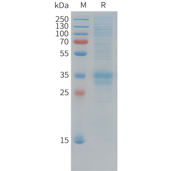 Human SHH (C-6His) Protein