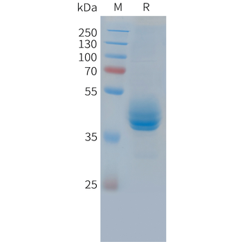 Human IFN gamma Protein