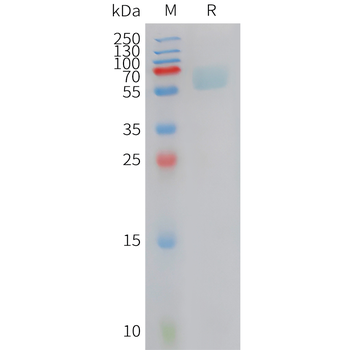 Human Vitronectin (N-Truncated, C-6His) Protein
