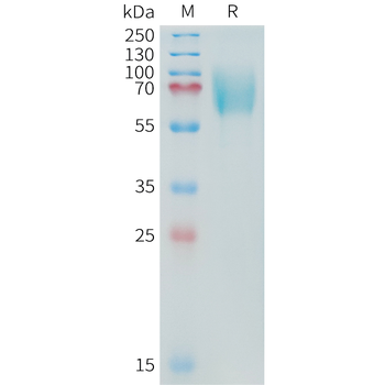 Human TNF alpha (N-6His) Protein