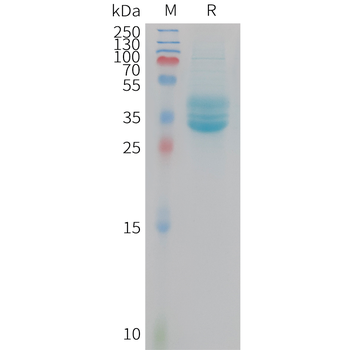 Human IRF5 (C-6His) Protein