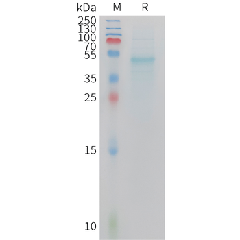 Human CCL3L1 (C-6His) Protein