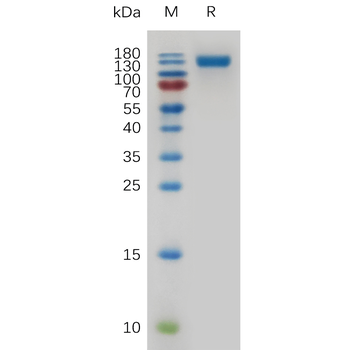 Human NRP2 Protein, His Tag