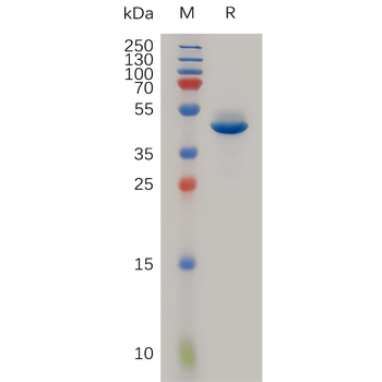 Human NLRP3 Protein, Flag Tag