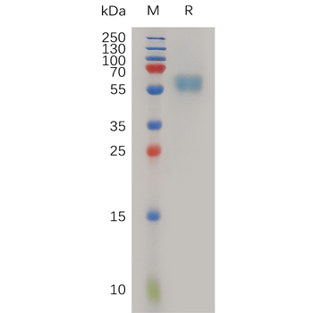 Human PRTN3 Protein, His Tag
