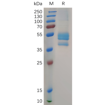 Human XAGE1A Protein, hFc Tag
