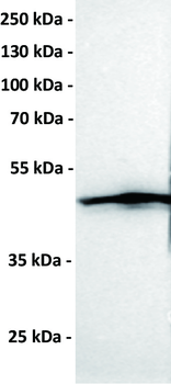 Anti-CCR1 antibody(DMC465); IgG1 Chimeric mAb