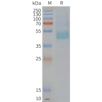 Human CMKLR1 full length protein-synthetic nanodisc