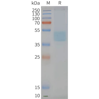 Human CXCR6 full length protein-synthetic nanodisc