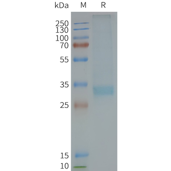 Human MC4R full length protein-synthetic nanodisc