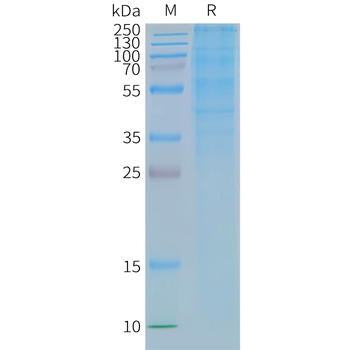 Human GLP1R full length protein-synthetic nanodisc